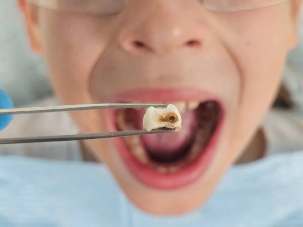 Best Pediatric Emergency Dentist in La Mesilla, NM